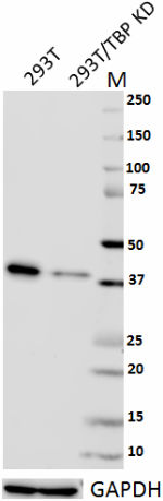 1TBP18_Purified_TataBindingProtein_Antibody_2_050318