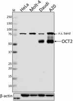 2B10B19_PURE_OCT2_Antibody_0_WB_120718