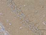 2_2E2dotD11_Purified_PPP3CA_Antibody_1_020619_updated.png
