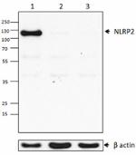 8F10B51_PURE_NLRP2_Antibody_1_WB_051016