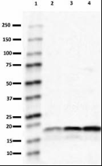 A15115A_HRP_alpha-synuclein_Antibody_1_022819_updated.png