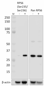 A17020B_DB-HRP_RPS6-Phospho_Antibody_022522