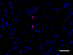A17183A_Purified_alpha-Synuclein_3_123119