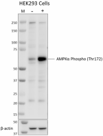 A20017A_PURE_Aquaporin-4_Antibody_1_120221