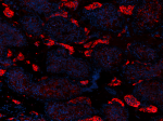 A20069I_PURE_ACE2_Antibody_3_061720.png