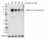 A20103O_PURE_SARS_CoV-2-S_Protein-S1_Antibody_2_031721