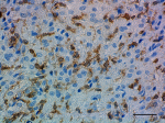 CPTC-Gelsolin-2_PURE_Gelsolin_Antibody_3_062719.png