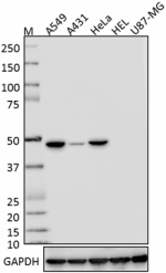 DA-7_pure_cytokeratin18_Antibody_1_062518