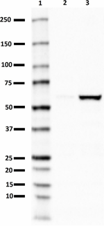 DU46-11_PURE_PINK1_Antibody_1_101519