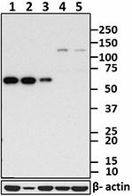 B_F45P9C7_PURE_hnRNPK_Antibody_WB_081616