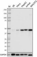 KrMab-3_PURE_IDH2_Antibody_1_080321.png