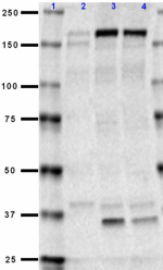 N59slash36_Purified_NMDAR2B_Antibody_1_031618