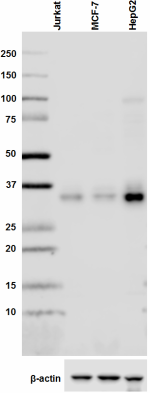 B-O94E6slashARG1_PURE_Arginase-1_Antibody_WB_011718
