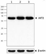 P81B6_PURE_AKT2_Antibody_WB_092915
