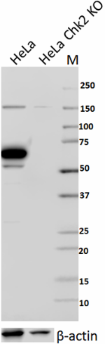 1_P81C12B8_PURE_CHK2_Antibody_1_WB_110617