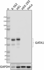 P84F5_PURE_GATA1_Antibody_1_081820
