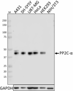 P87F12H6_PURE_PP2C-alpha_Antibody_052019.png