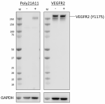 Poly21A11_PURE_VEGFR2_Antibody_112222