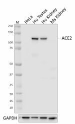 2_Poly5036_LEAF_ACE2_Antibody_2_012721.png
