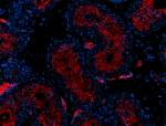 3_Poly5036_LEAF_ACE2_Antibody_3_030521.png