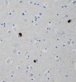Syn303_Purified_a-synuclein_Antibody_IHC_021715