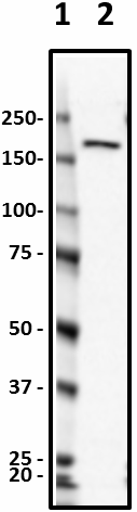 TD1_Pure_CLTCL2_Antibody_2_051519