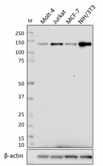 W15202A_PURE_HDAC5_Antibody_WB_031519_updated.png