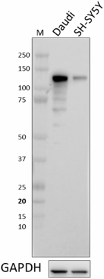 W17026A_PURE_NFATC4_Antibody_2_070519