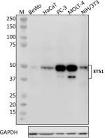 W17042D_PURE_ETS1_Antibody_080519