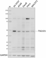 W19019A_PURE_TSG101_Antibody_1_080921.png