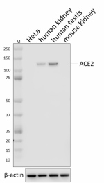A20069I_PURE_ACE2_Antibody_4_061720.png